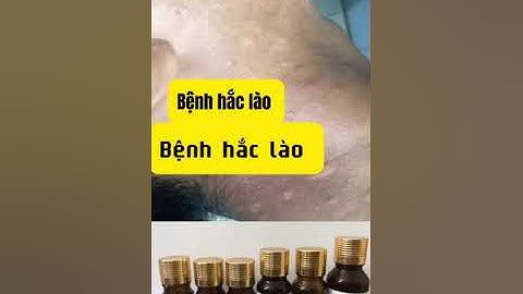 BỆNH HẮC LÀO | Bệnh hắc lào bôi thuốc gì để khỏi dứt điểm