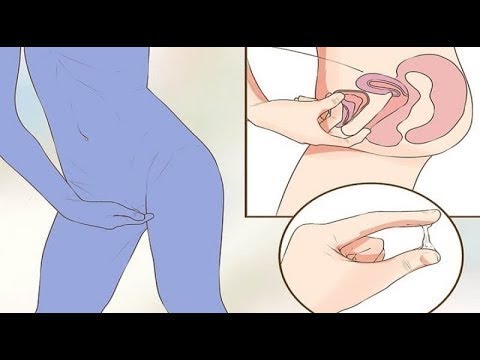 Video: Cervix Penetration: 10 Ting, Du Skal Vide