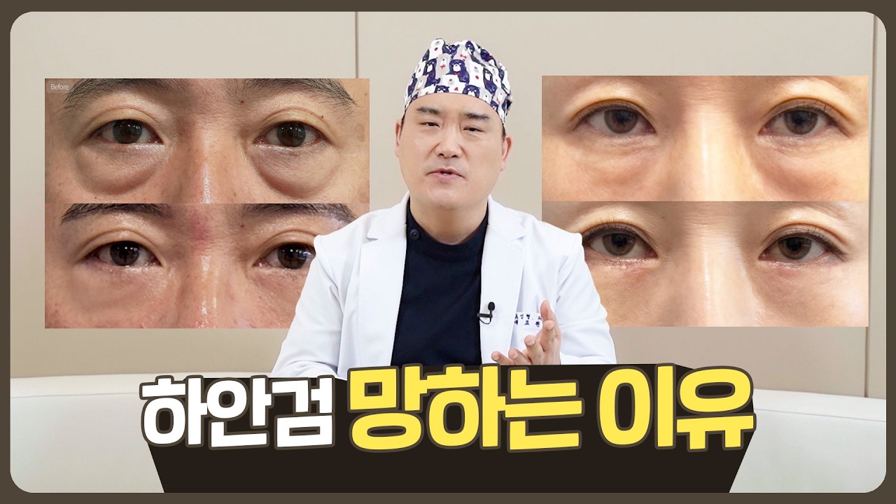 하안검 망하는 이유!