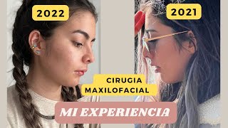 Mi experiencia. Recuperación post cirugía Maxilofacial/ortognatica Durante 1 mes (parte 2)