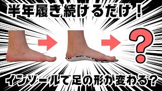 Can Wearing Insoles Long-Term Change the Shape of Your Feet? - YouTube