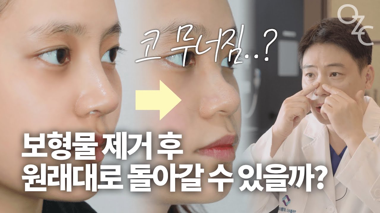 코 성형 후 보형물을 빼면 원래대로 돌아갈까? _[코성형 전문 앤플러스]