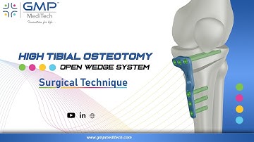 HIGH TIBIAL OSTEOTOMY OPEN WEDGE SYSTEM - SURGICAL TECHNIQUE