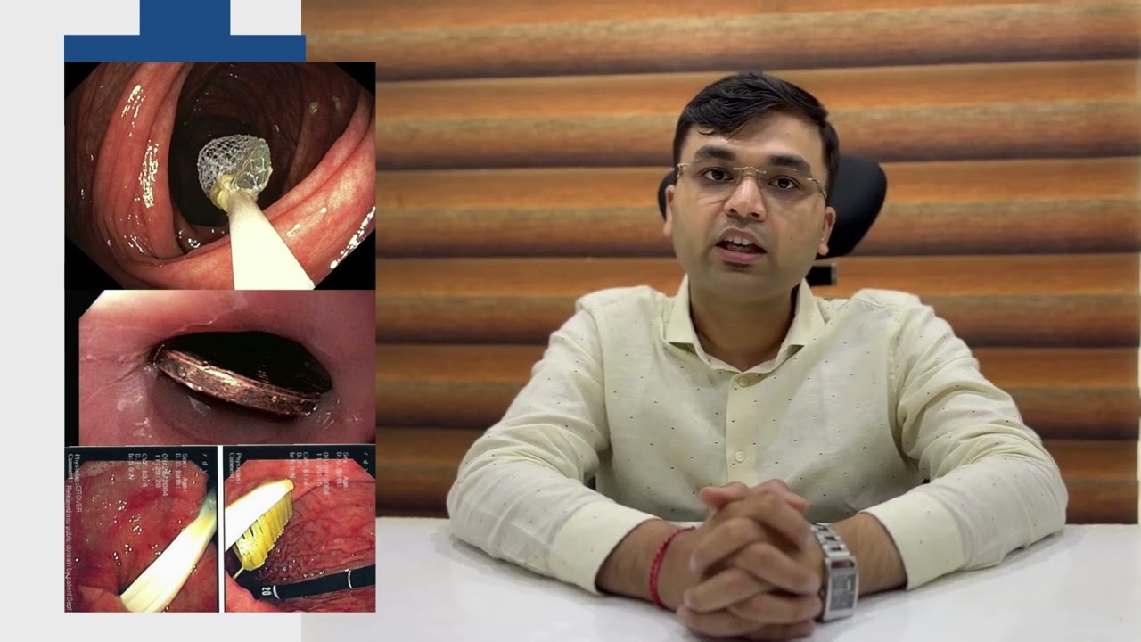 Foreign body ingestion in GIT