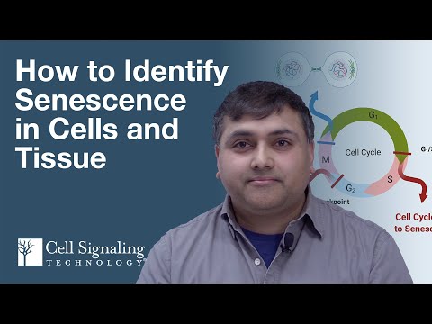 How to Identify Senescence in Cells and Tissue | CST Tech Tips