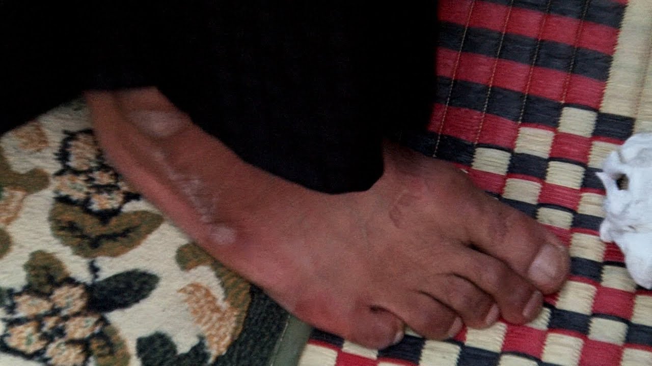 يصعد المنصه حافي ويشكي حال اهالي البصره الى الامام العباس ع  المهوال كرار البصيري