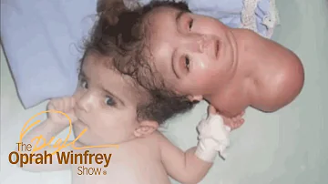 The 2-Headed Baby Miracle | The Oprah Winfrey Show | Oprah Winfrey Network