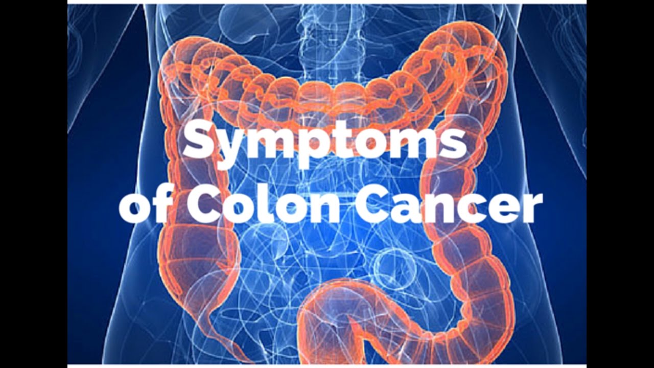 8 Early Warning Signs Of Colon Cancer - YouTube