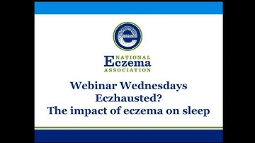 Eczhausted? The impact of eczema on sleep