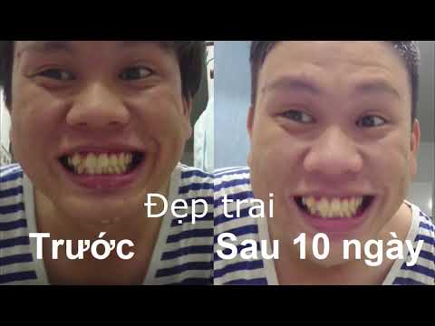 Video Review Kem đánh răng SPLAT White Plus sau 2 tháng rưỡi - youtube