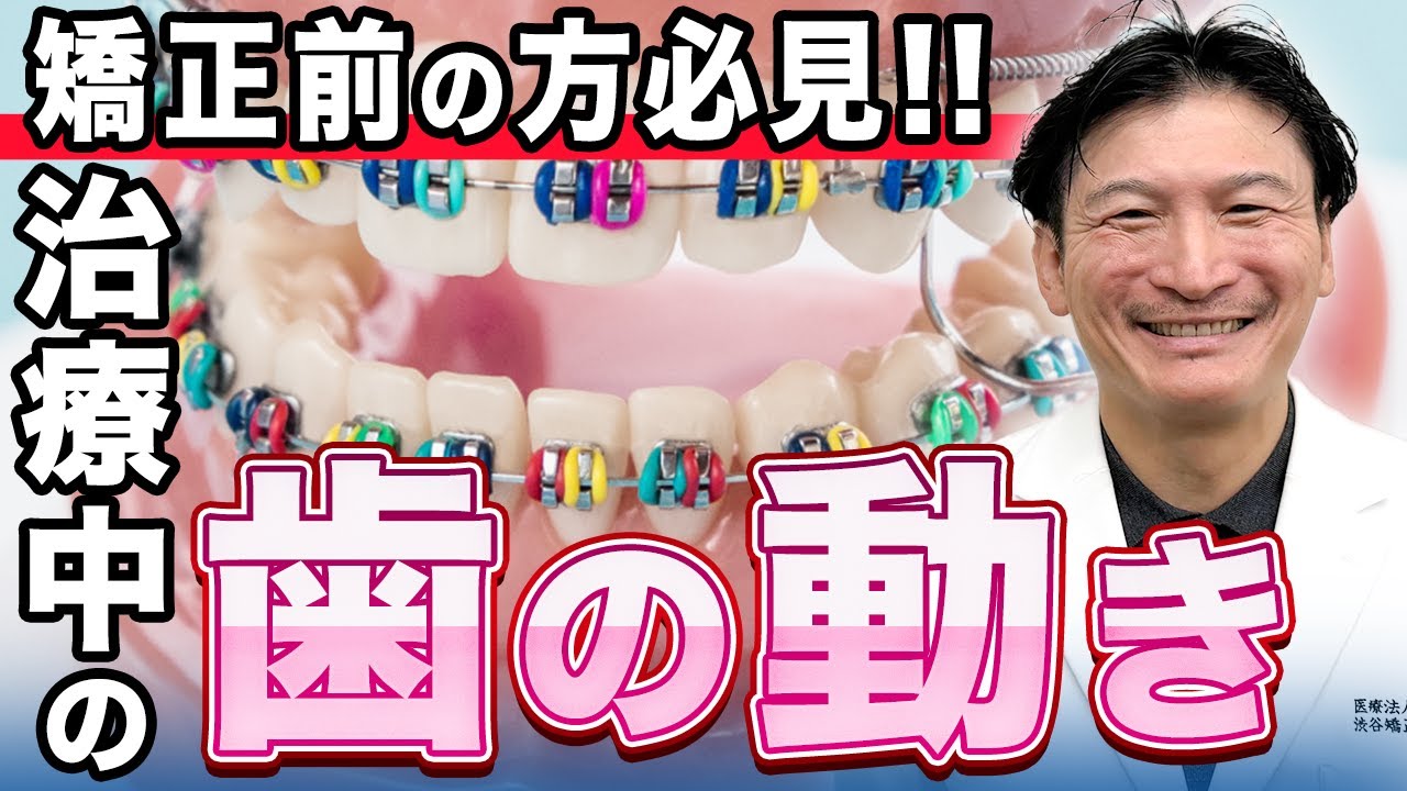 【歯列矯正】歯が動く仕組みを矯正歯科医が解説します! - YouTube Bild & Inspiration 【歯列矯正】歯が動く仕組みを矯正歯科医が解説します! - YouTube Motiv