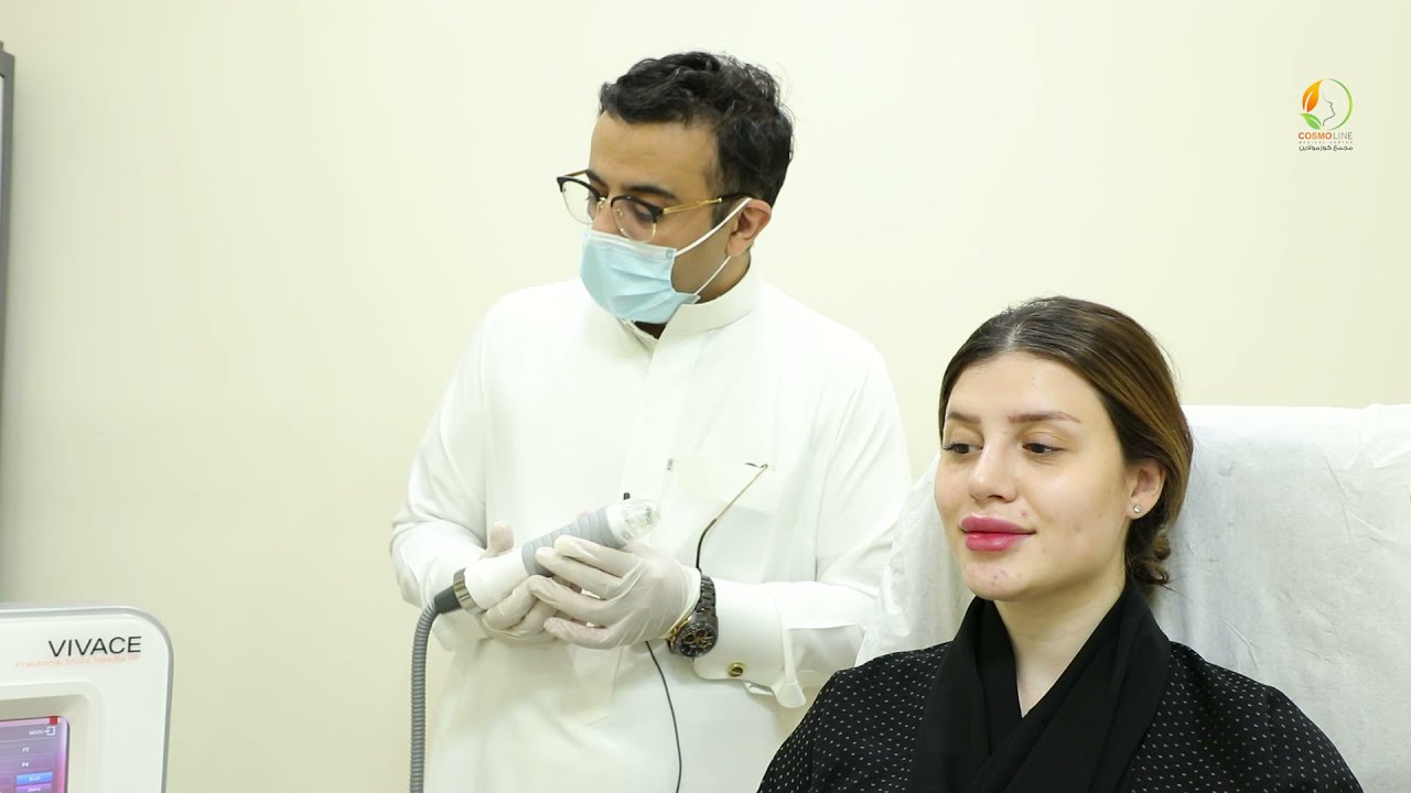 جهاز فيفاتشي #VIVACE لعلاج الندبات وتحفيز #الكولاجين