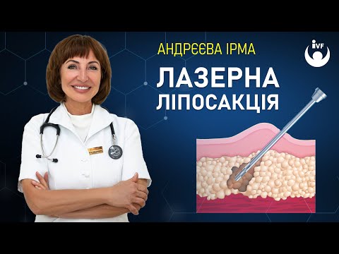 Лазерная липосакция: нужна ли она и как проводится? /Рассказывает дерматохирург Андреева Ирма