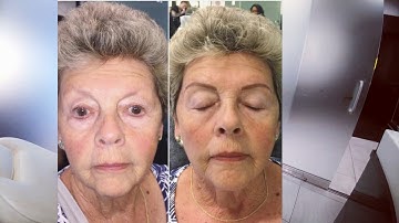 How does Microblading work ?