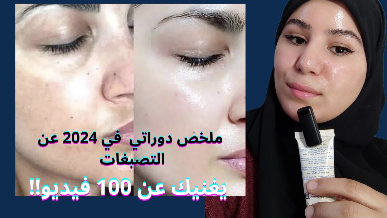 ملخص عام عن التصبغات أسبابها و أنواعها و علاجها👌عطيتك المختصر المفيد‼️غتعالجي تصبغاتك لوحدك‼️