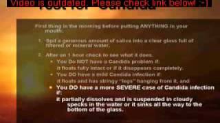 Omg Amazing How To Treat And Cure Yeast Infection Fast And Safely At Home