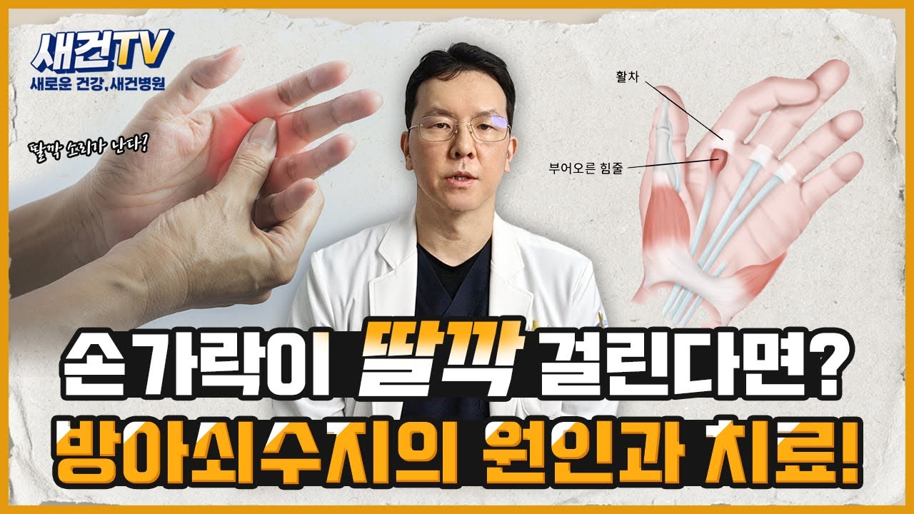 손가락이 딸깍 걸린다면? 방아쇠수지의 원인과 치료!