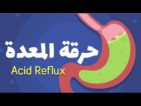 Acid Reflux In Arabic
