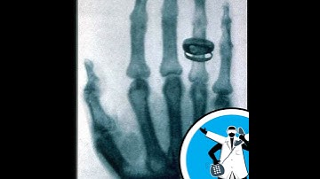 Broken Bones and Glowing Worms