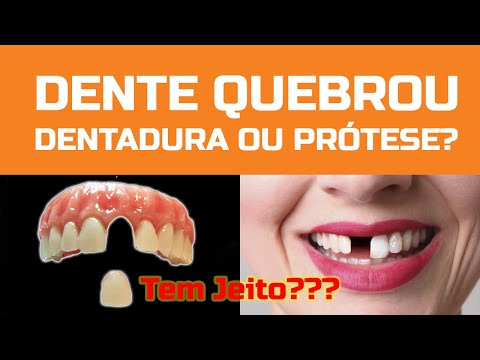Dente da Dentadura