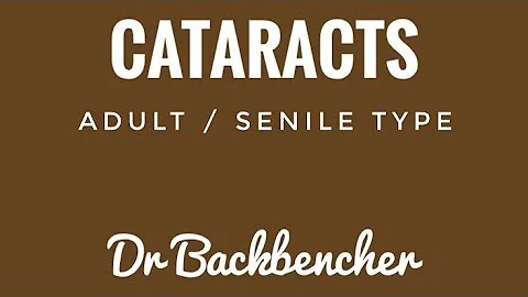 Adult Cataracts - Causes, symptoms, complications and treatment - Ophthalmology Lectures - DayDayNews