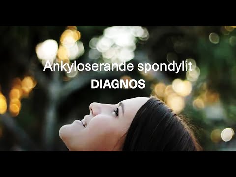 Diagnos av ankyloserande spondylit