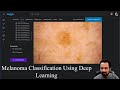 Detecting Skin Cancer (Melanoma) With Deep Learning