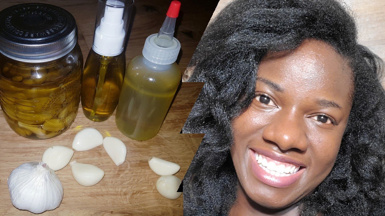Diy Garlic oil for hair growth, Hair loss, and dandruff remedy. YouTube