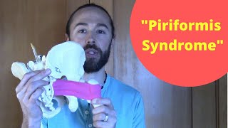 "Piriformis Syndrome" (How it causes Sciatic Nerve Pain)