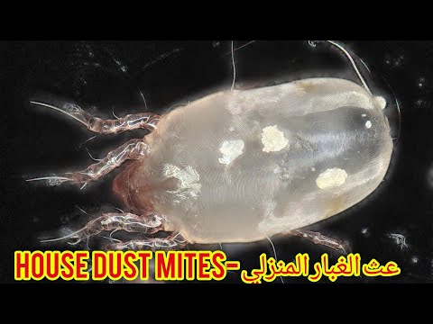 فيديو: Dermatophagoides pteronyssinus - ما هي وما هي الأمراض التي تسببها؟ عث الغبار - كيفية التخلص منه في المنزل