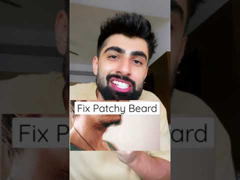 How To Grow Full Beard ASAP | Mridul Madhok