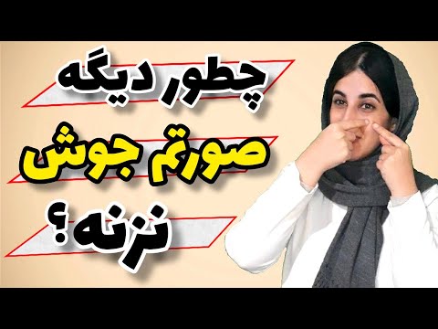 تصویری: 5 روش خشک کردن جوش ها