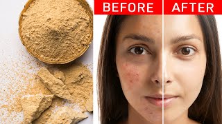 Unlock Natural Beauty with Multani Mitti: Treat Acne, Tan, and Promote Hair Growth! 🌿💁‍♀️