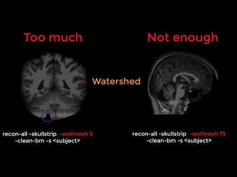 FreeSurfer #13: SkullStripping and Pial Surface Errors