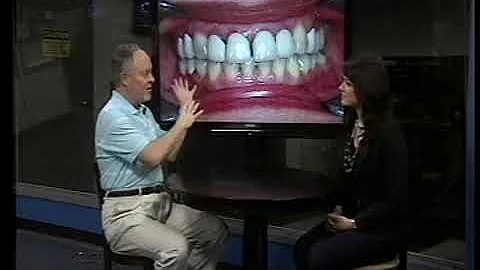 Porcelain Crowns - The Art of Dentistry - Dr. Robi...