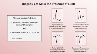 Intro to EKG Interpretation - Myocardial Infarctions (Part 2 of 2)