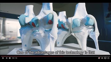 New Cartilage Regeneration Technology