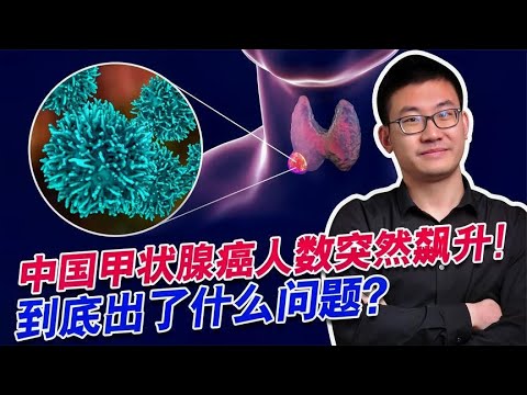 加碘盐食用过多，是甲状腺癌症高发的原因吗？