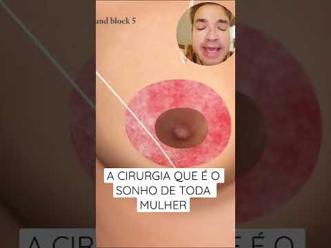 Vídeo: Como reduzir visualmente seios grandes: 15 etapas (com fotos)