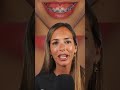 ¿Enseñas MUCHA ENCÍA cuando sonríes? Cómo solucionar la SONRISA GINGIVAL con brackets #shorts