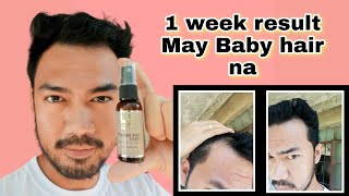 Purc Hair Growth Spray First Week Of Using May Baby Na Agad