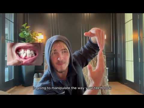 Jawline Pitfalls | Baby Stickley Looksmaxxing Course 
