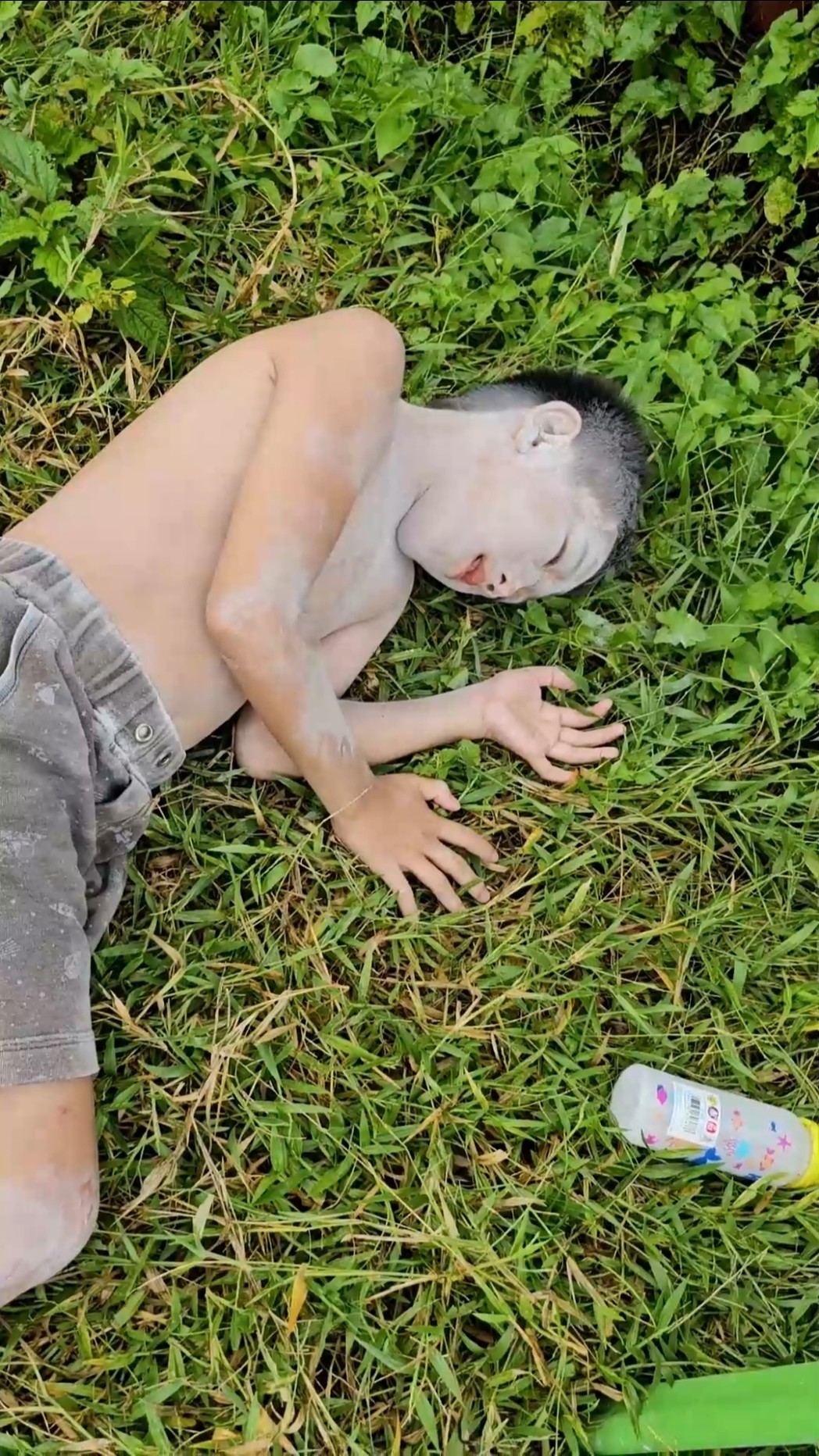 Why do you drink milk when you get bitten