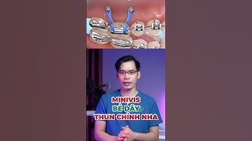 REACTION Khí Cụ Hỗ Trợ Tróng Đánh Lún Phục Hồi Răng Mất #shorts  #nhakhoathainguyen  #xuhuong