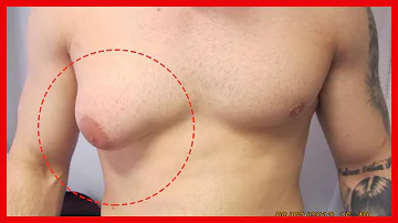 Wie entstehen Männer Brüste?