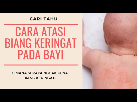 Video: Miliaria Pada Bayi Dan Bayi Baru Lahir - Penyebab, Gejala, Dan Pengobatan Biang Keringat Pada Bayi Baru Lahir?