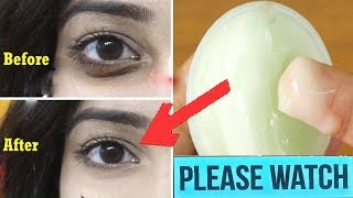 Dark Circles, Wrinkles Removal, Anti Ageing Eye Cream DIY/ Powerfull Homemade Under Eye Gel