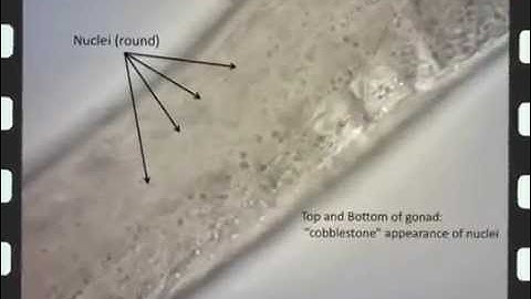 Injection of C. elegans Gonads
