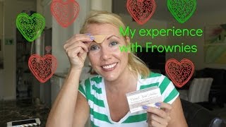 My experience with Frownies with before and after photo! | BEAUTY OVER 40