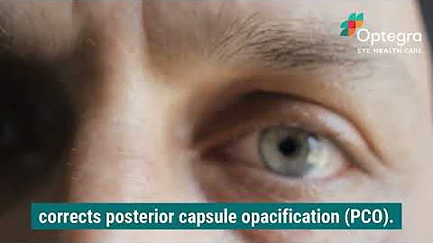 YAG Laser Capsulotomy Explained | Quick Treatment for Blurry Vision After Cataract Surgery